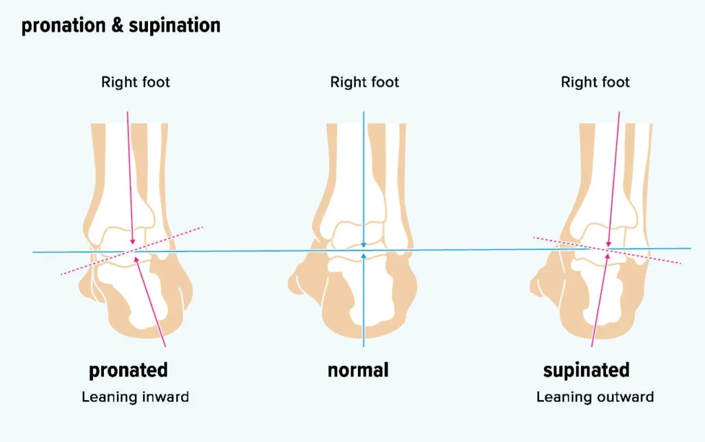 different foot shapes