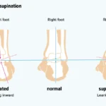 different foot shapes