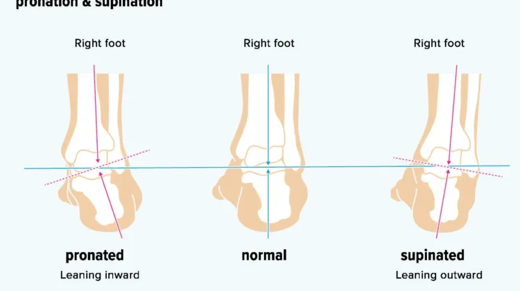 different foot shapes